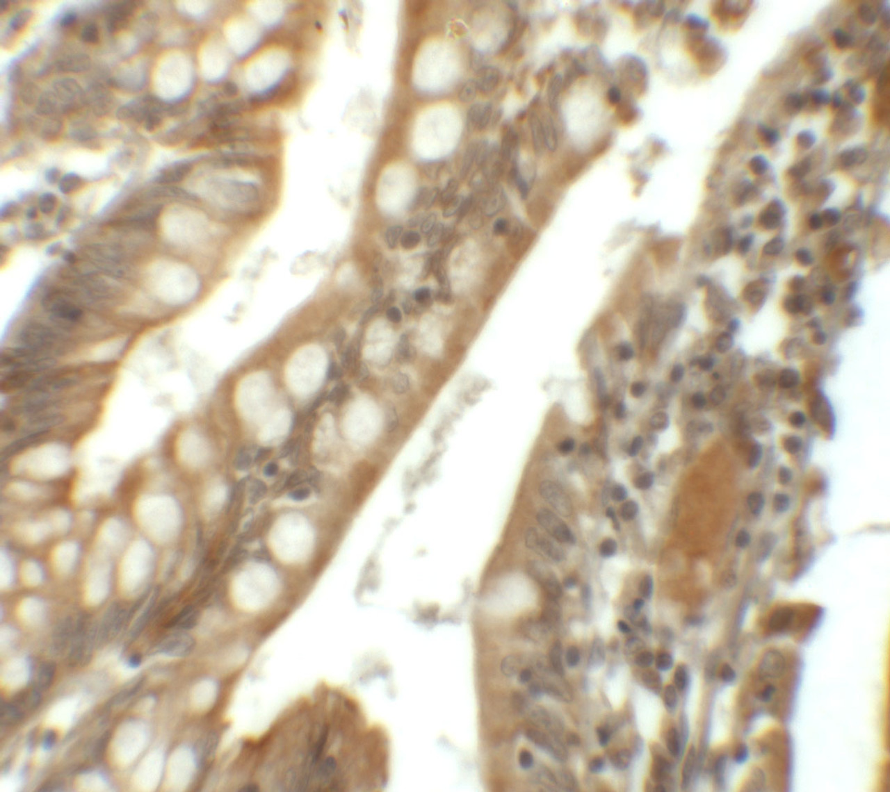 Immunohistochemistry of SIK1 in human small intestine tissue with SIK1 antibody at 5 ug/mL.