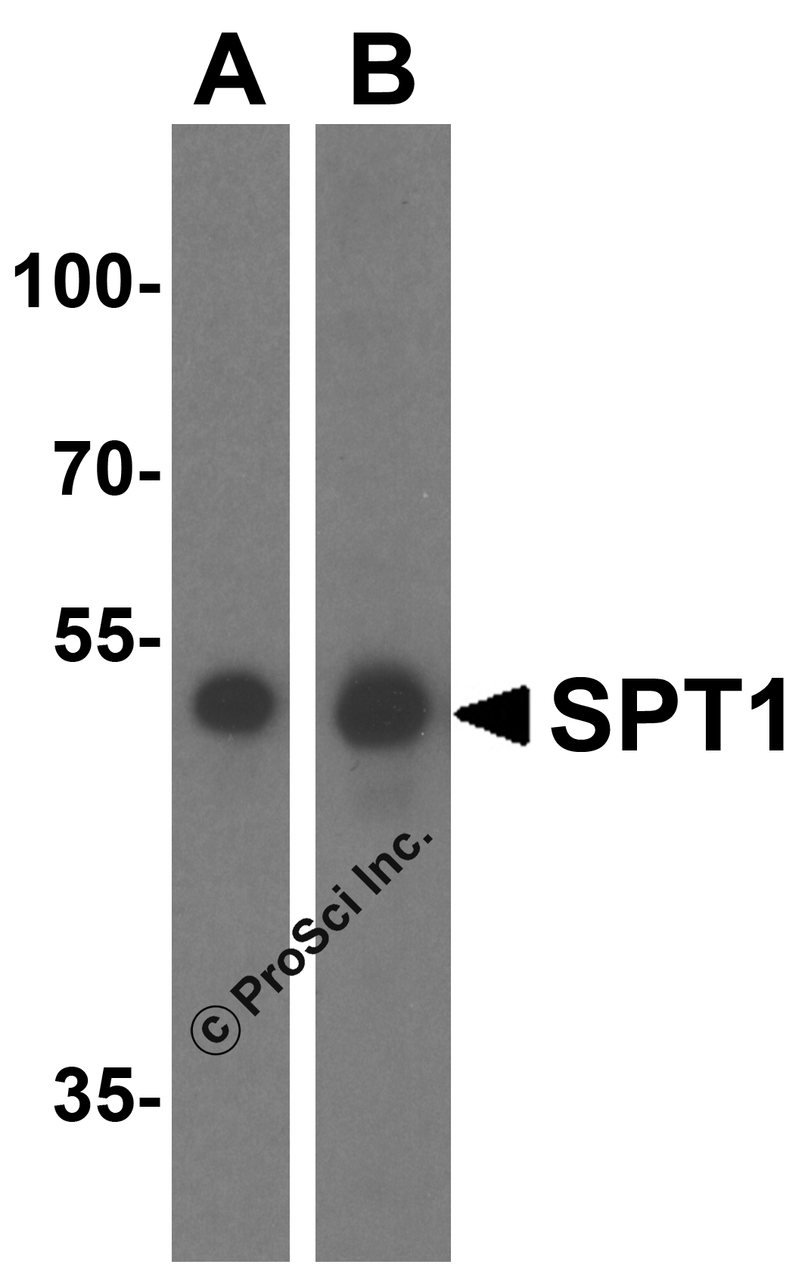 Western blot analysis of SPT1 in (A) A549 and (B) HeLa cell lysate with SPT1 antibody at 1 &#956;g/mL.