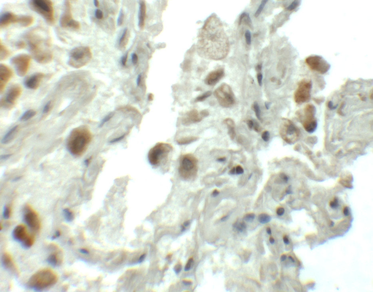 Immunohistochemistry of SPT1 in human lung tissue with SPT1 antibody at 5 ug/mL.