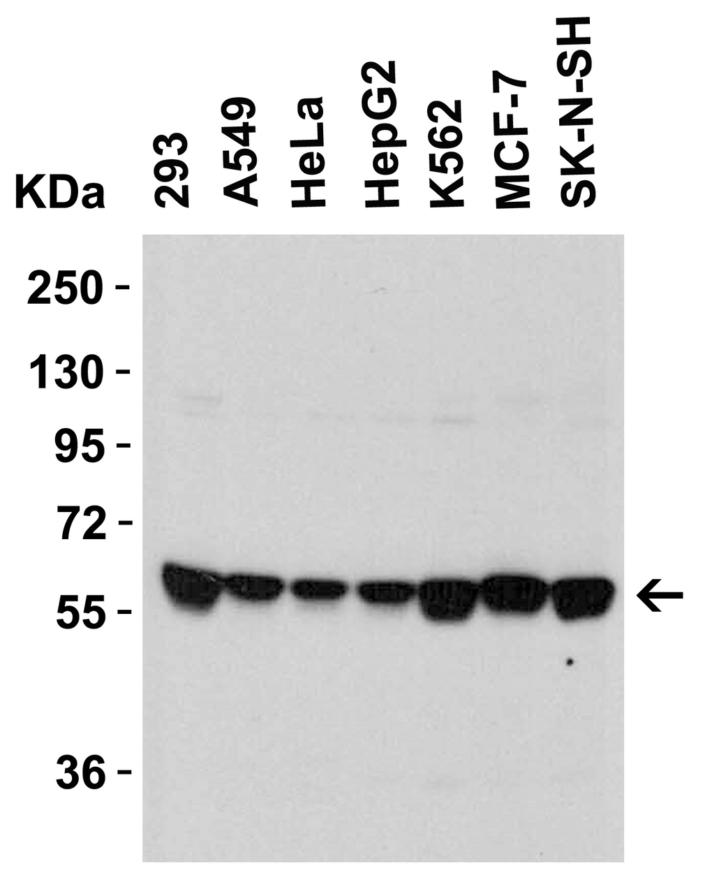 Figure 2 Western Blot Validation in Human Cell Lines
Loading: 15 ug of lysates per lane.
Antibodies: SPT2, 6305 (1 ug/mL) , 1h incubation at RT in 5% NFDM/TBST.
Secondary: Goat anti-rabbit IgG HRP conjugate at 1:10000 dilution.