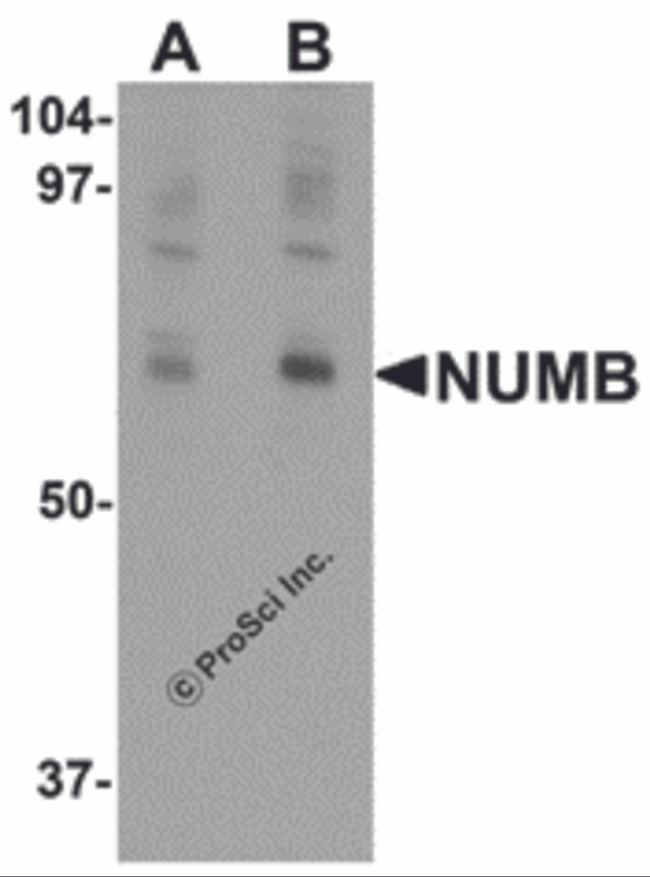 Western blot analysis of NUMB in mouse lung tissue lysate with NUMB antibody at (A) 0.25 and (B) 0.5 &#956;g/mL.