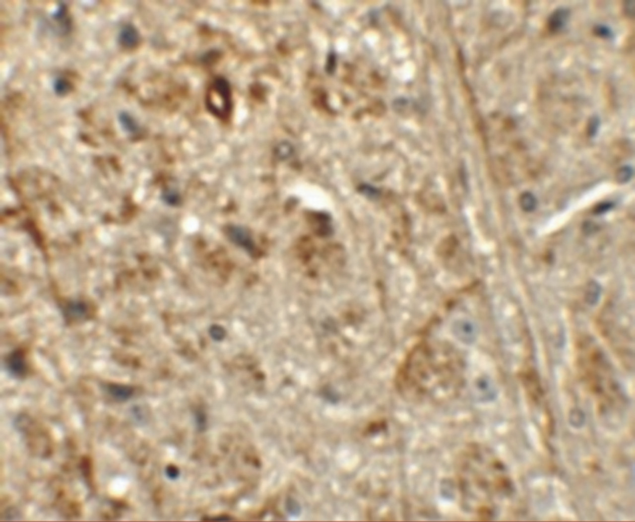 Immunohistochemistry of ORMDL1 in mouse brain tissue with ORMDL1 antibody at 5 ug/mL.