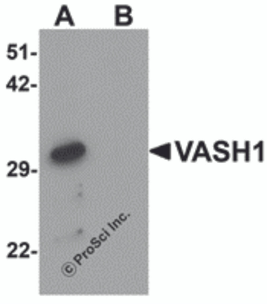 Western blot analysis of VASH1 in human brain tissue lysate with VASH1 antibody at 1 &#956;g/mL in (A) the absence and (B) the presence of blocking peptide.