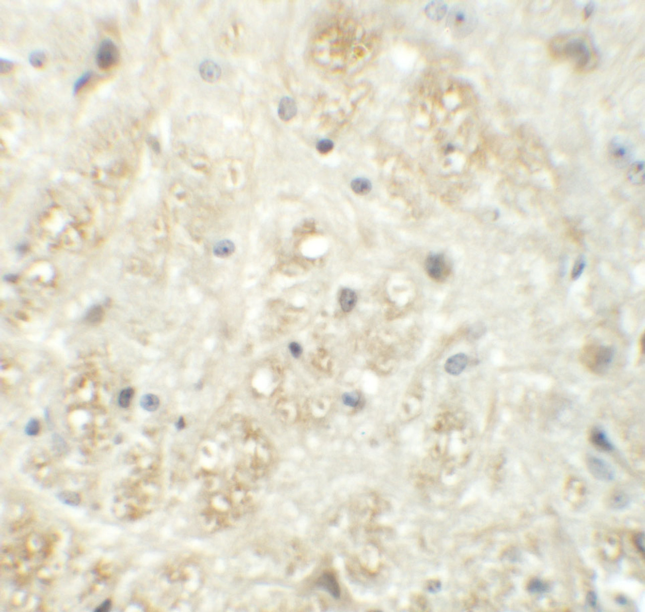 Immunohistochemistry of VASH1 in mouse brain tissue with VASH1 antibody at 5 ug/mL.