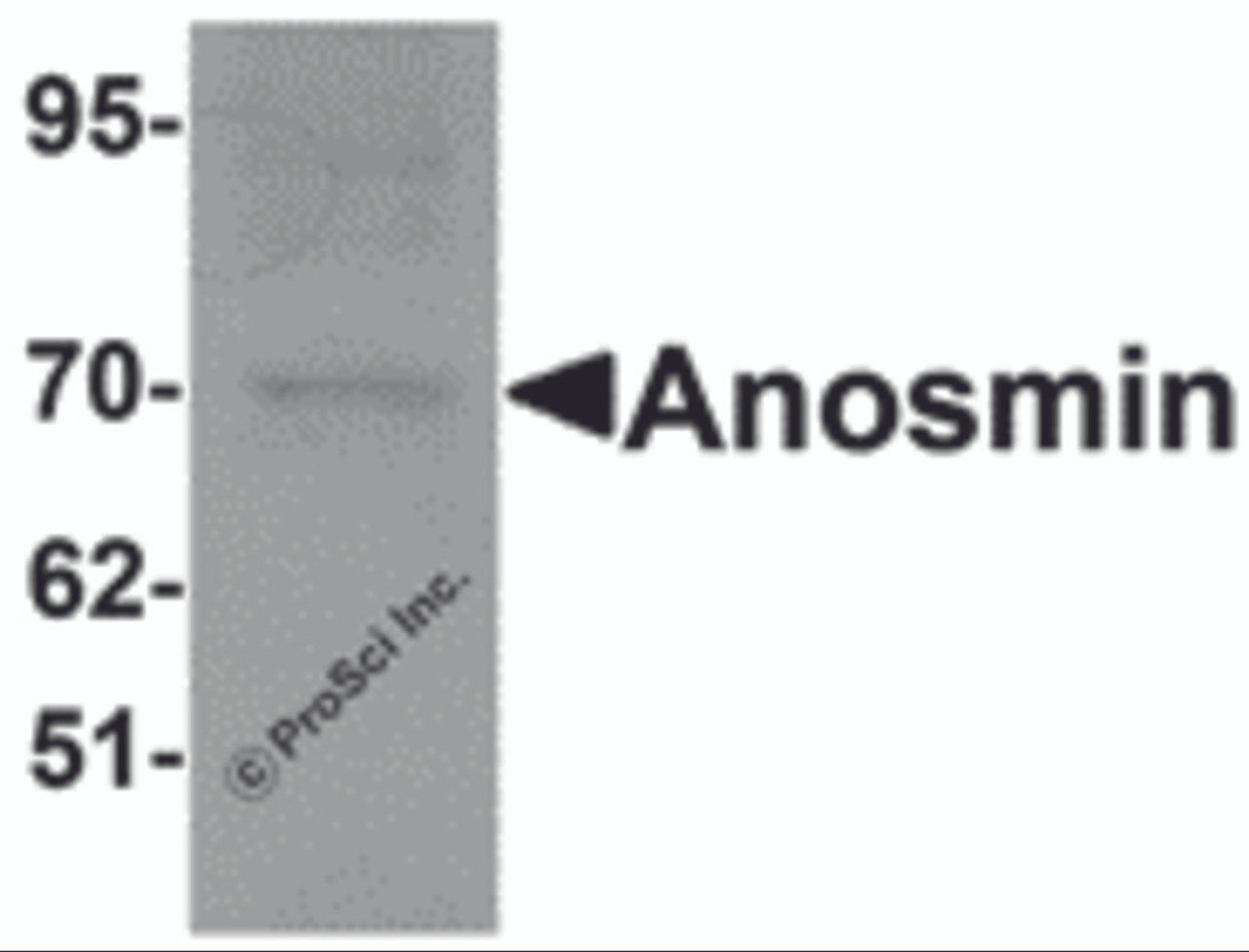 Western blot analysis of Anosmin in MCF7 cell lysate with Anosmin antibody at 1 &#956;g/mL.
