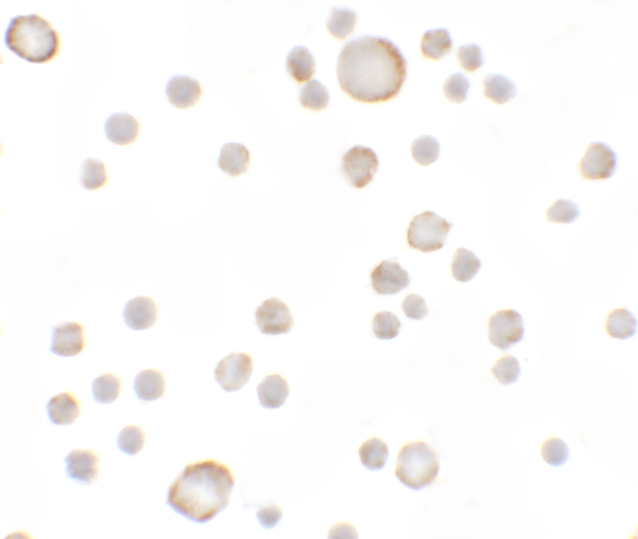 Immunocytochemistry of Anosmin in MCF7 cells with Anosmin antibody at 5 ug/mL.
