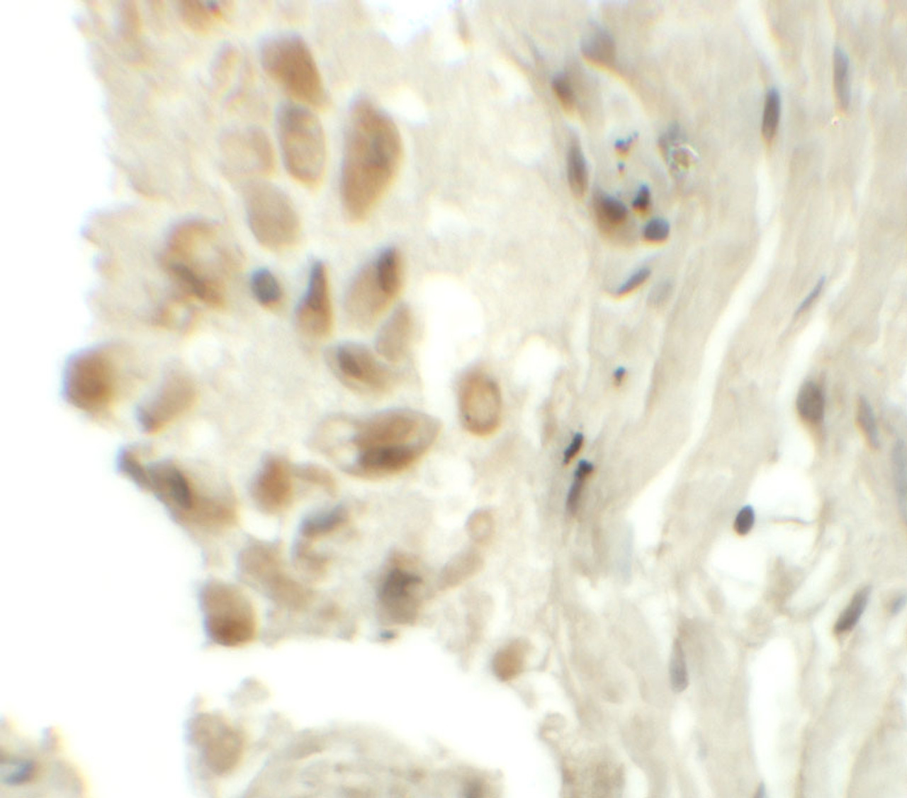 Immunohistochemistry of TYW1 in human lung tissue with TYW1 antibody at 5 ug/mL.