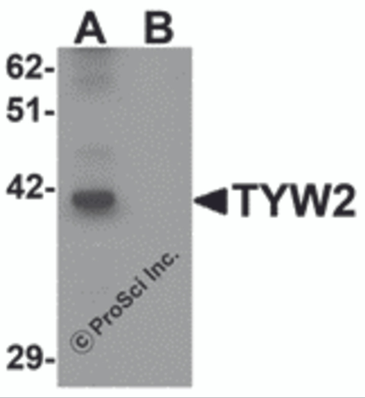 Western blot analysis of TYW2 in K562 cell lysate with TYW2 antibody at 0.5 &#956;g/mL in (A) the absence and (B) the presence of blocking peptide.