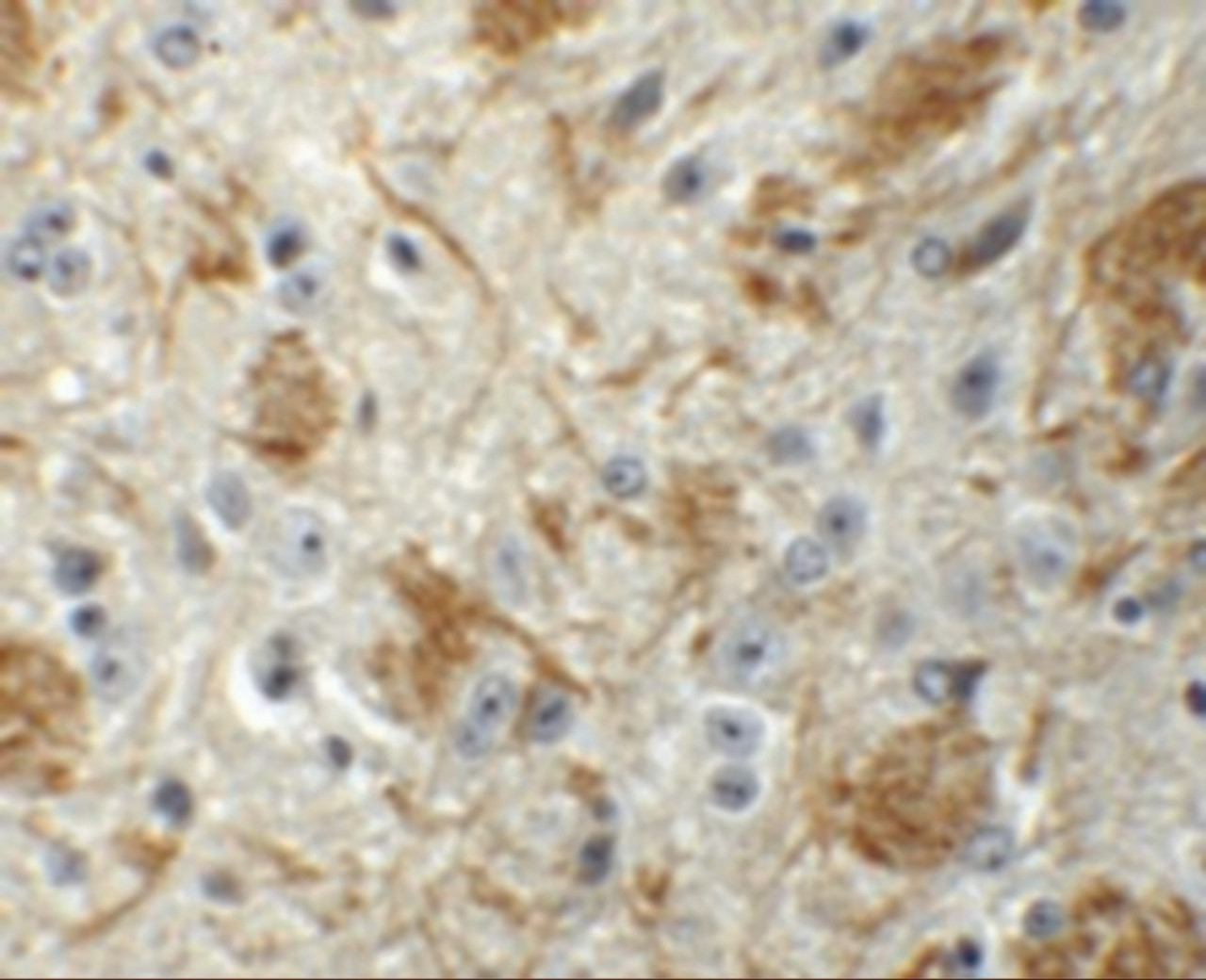 Immunohistochemistry of TYW4 in mouse brain tissue with TYW4 antibody at 5 ug/mL.