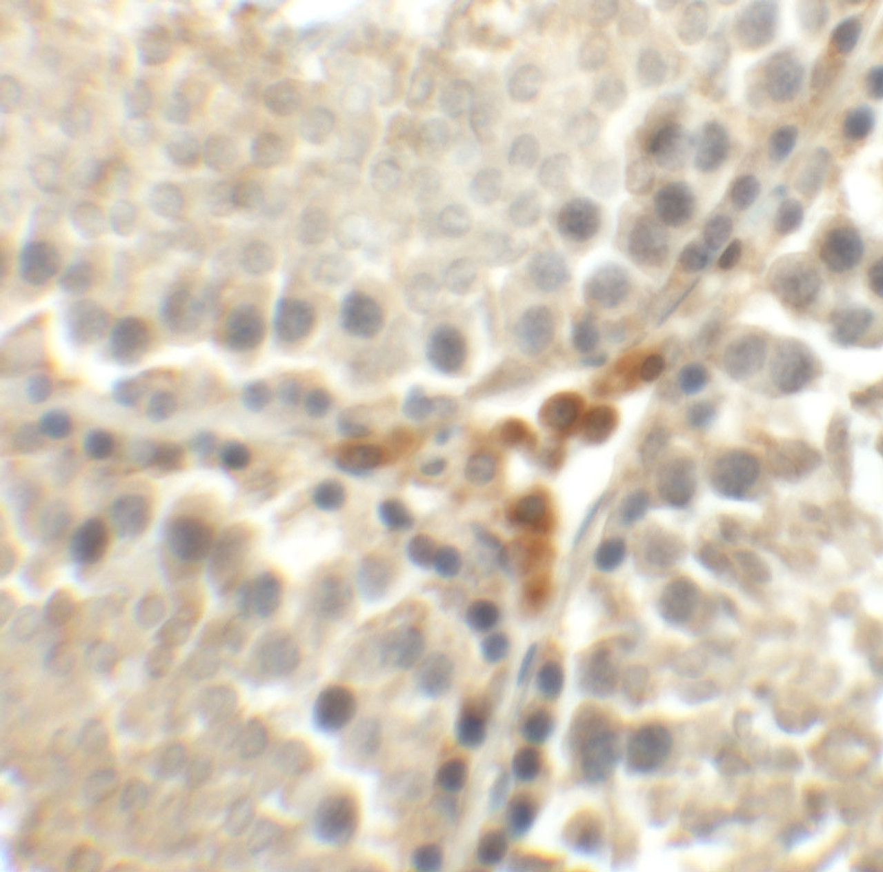 Immunohistochemistry of MEIG1 in rat testis tissue with MEIG1 antibody at 5 ug/mL.