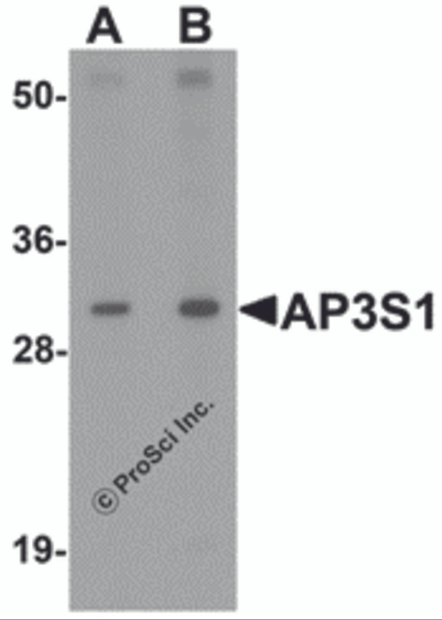Western blot analysis of AP3S1 in mouse kidney tissue lysate with AP3S1 antibody at (A) 1 and (B) 2 &#956;g/mL .