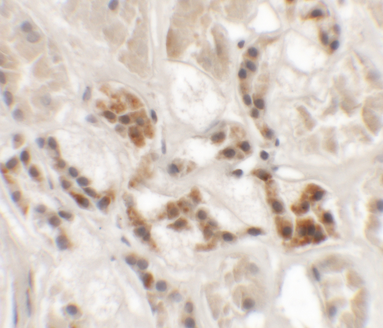 Immunohistochemistry of AP3S1 in human kidney tissue with AP3S1 antibody at 2.5 ug/mL.