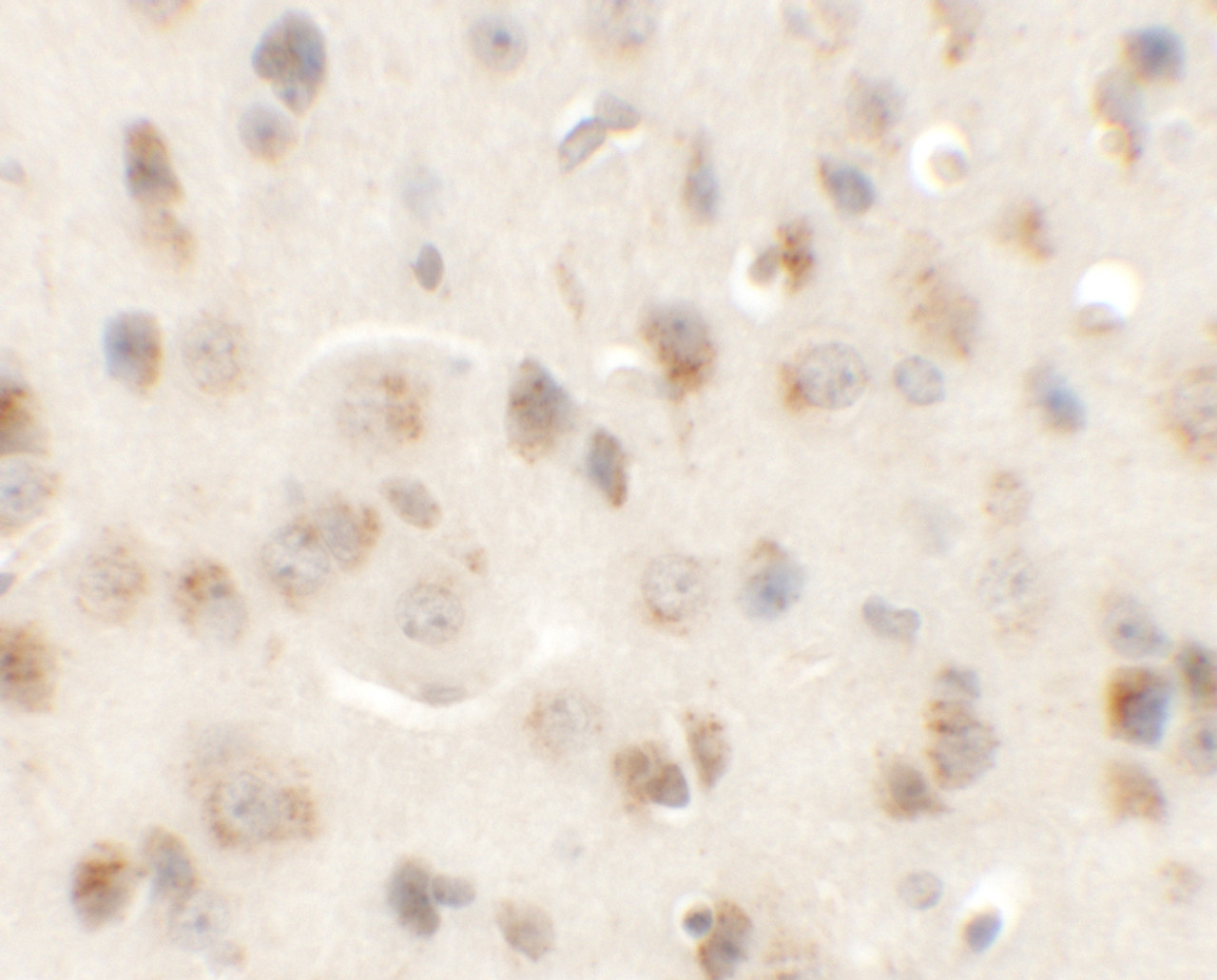 Immunohistochemistry of AP3M1 in mouse brain tissue with AP3M1 antibody at 5 ug/mL.