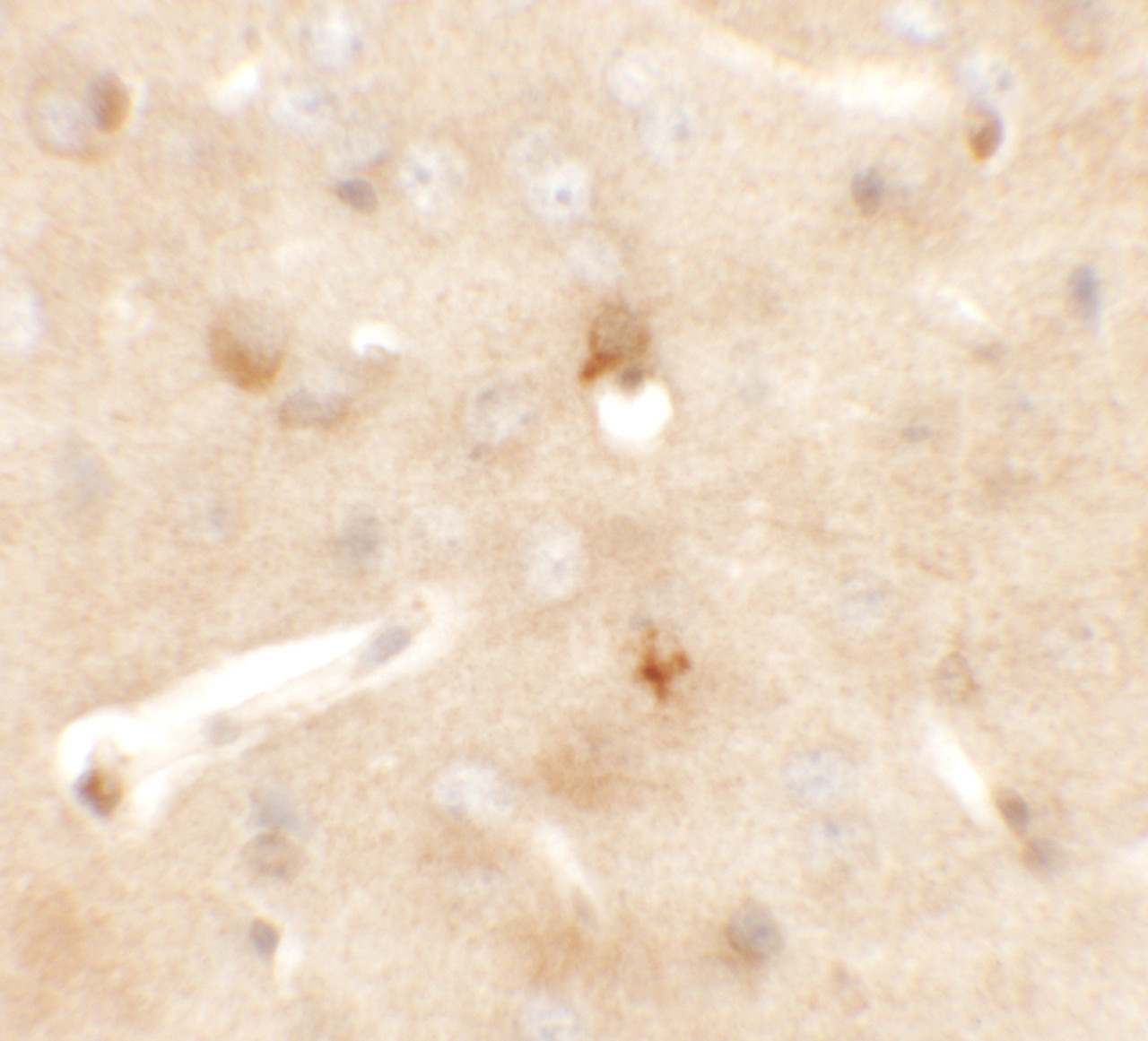 Immunohistochemistry of CCDC141 in mouse brain tissue with CCDC141 antibody at 5 ug/mL.