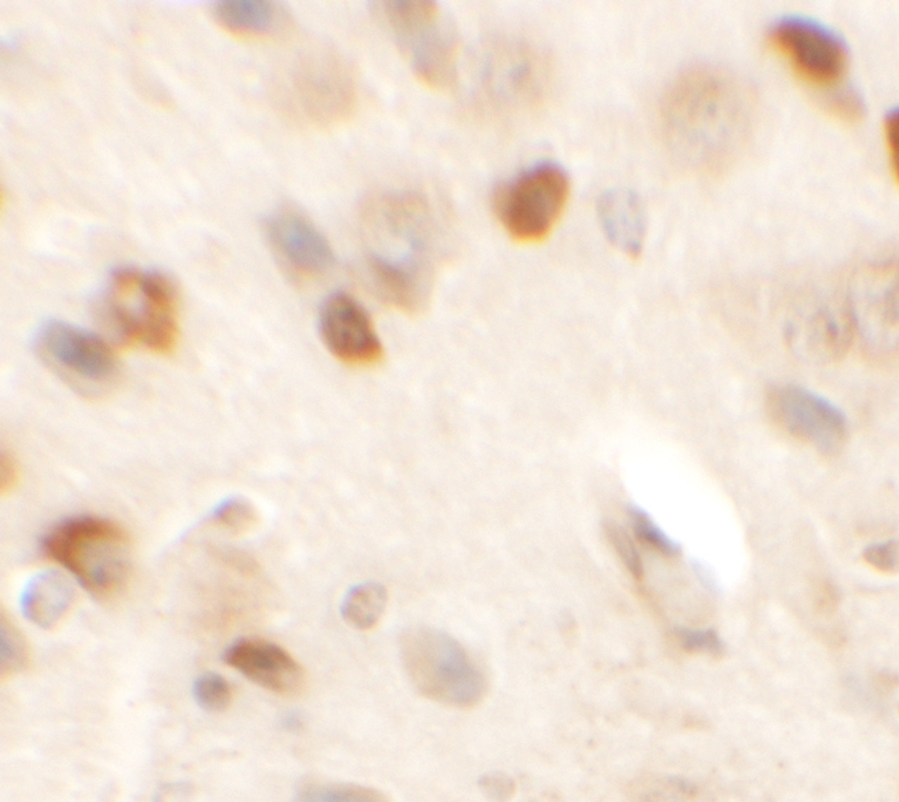 Immunohistochemistry of SPRYD2 in mouse brain tissue with SPRYD2 antibody at 2.5 ug/mL.