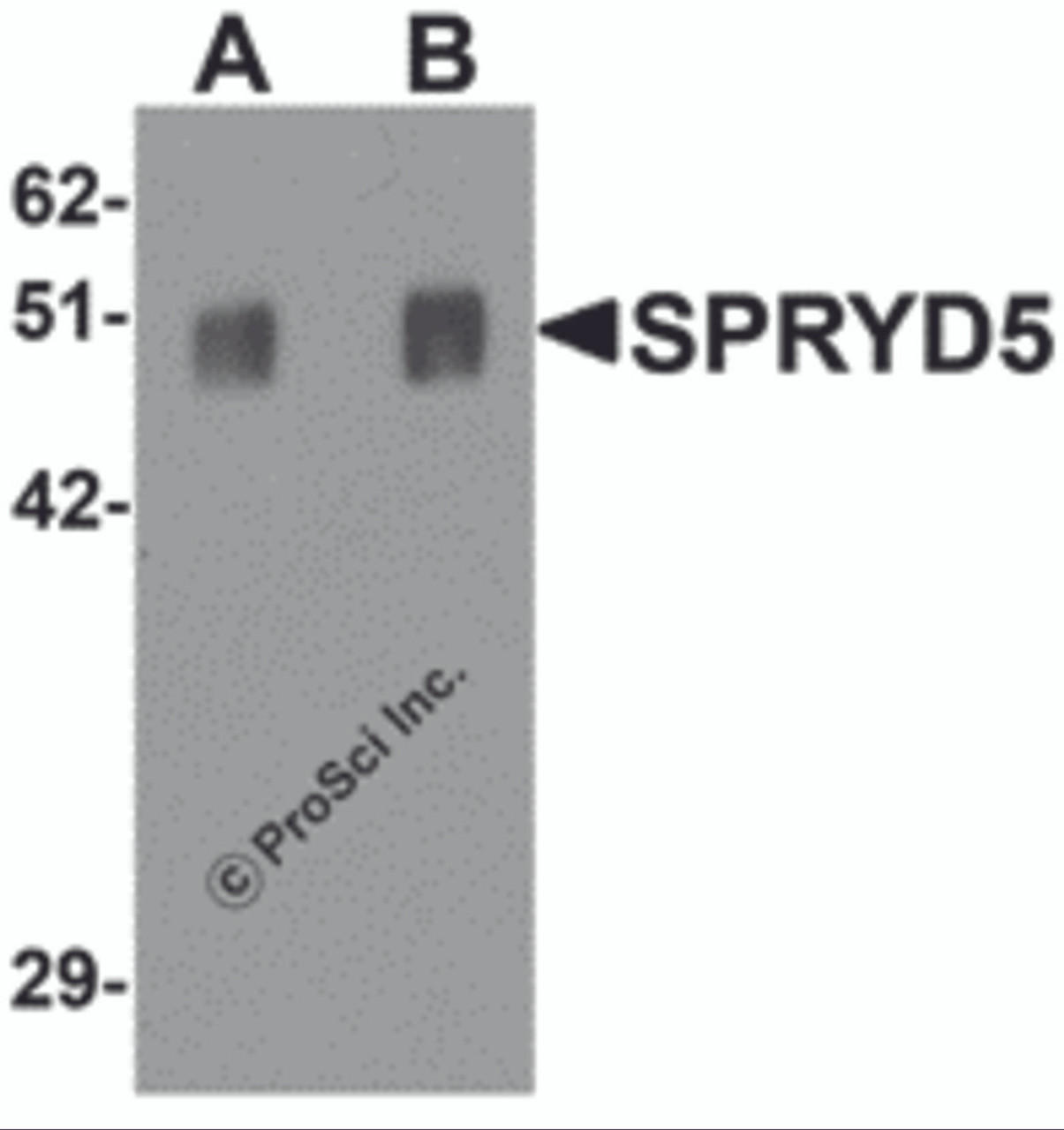 Western blot analysis of SPRYD5 in rat brain tissue lysate with SPRYD5 antibody at (A) 0.25 and (B) 0.5 &#956;g/mL .