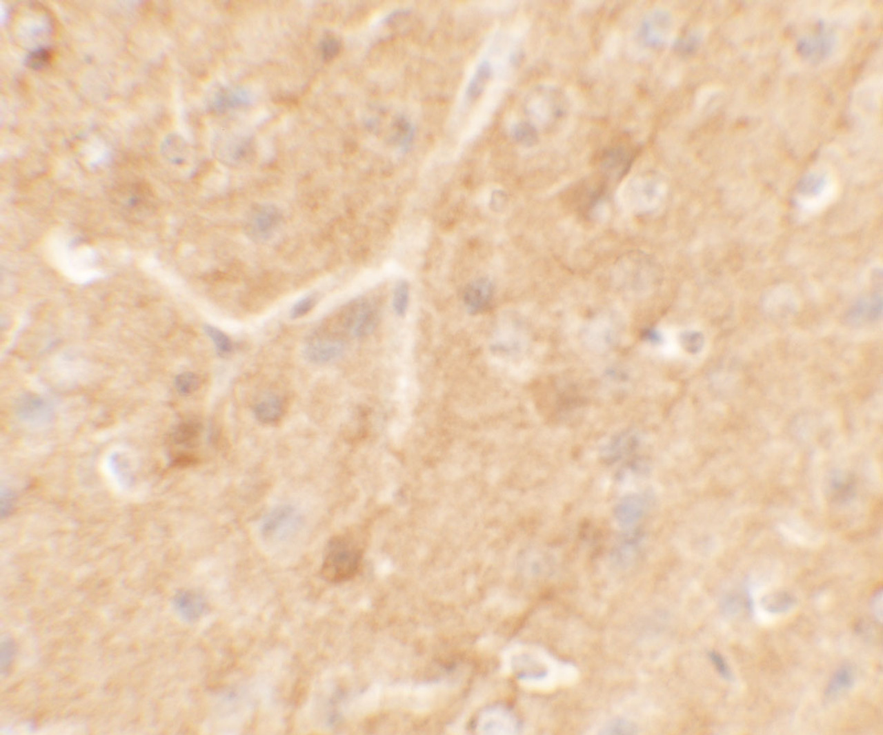 Immunohistochemistry of SPRYD5 in mouse brain tissue with SPRYD5 antibody at 5 ug/mL.