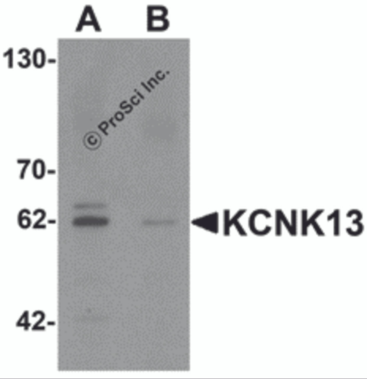 Western blot analysis of KCNK13 in rat brain tissue lysate with KCNK13 antibody at 0.5 &#956;g/mL in (A) the absence and (B) the presence of blocking peptide.