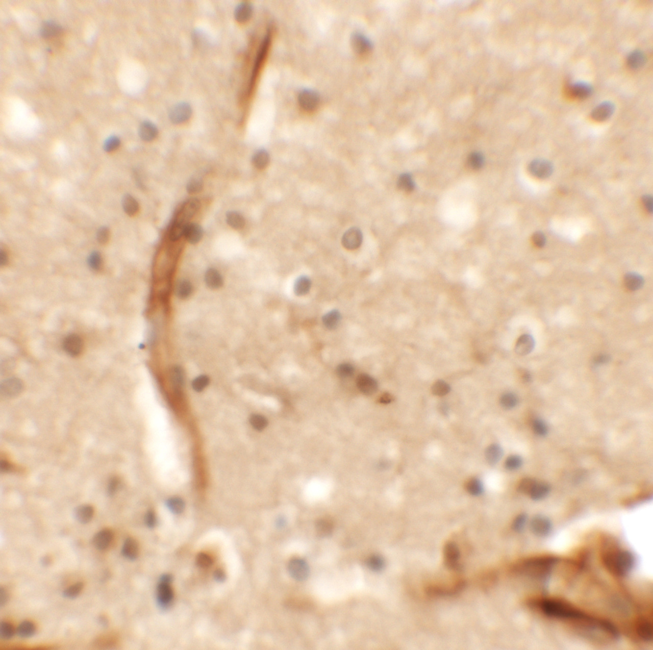 Immunohistochemistry of KCNK13 in human brain tissue with KCNK13 antibody at 5 ug/mL.