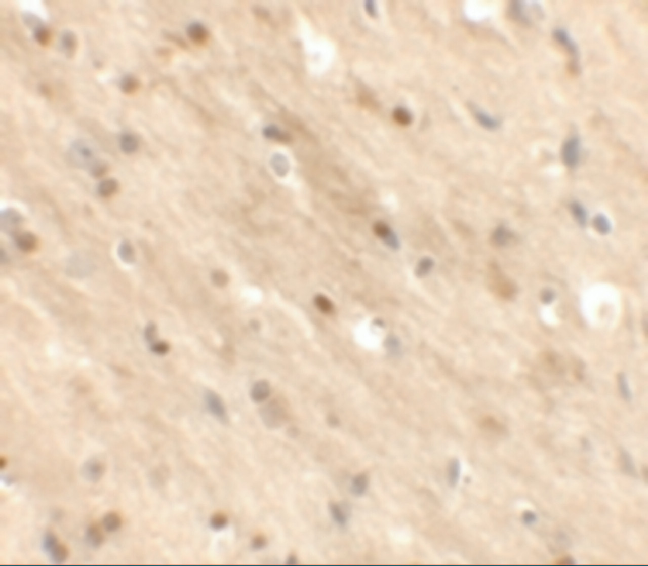 Immunohistochemistry of TMEM59L in mouse brain tissue with TMEM59L antibody at 2.5 ug/mL.