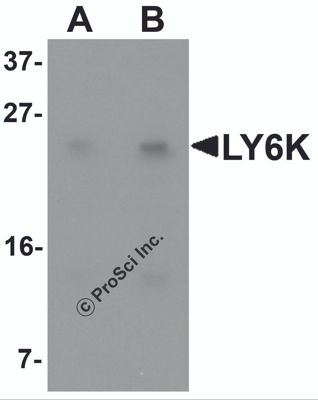 Western blot analysis of LY6K in HeLa cell lysate with LY6K antibody at (A) 1 and (B) 2 &#956;g/mL.