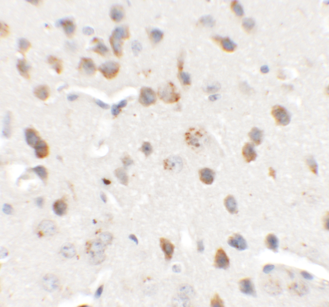 Immunohistochemistry of CHD7 in mouse brain tissue with CHD7 antibody at 5 ug/mL.