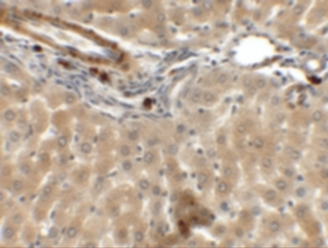 Immunohistochemistry of IFTLD1 in rat liver tissue with IFTLD1 antibody at 5 ug/mL.