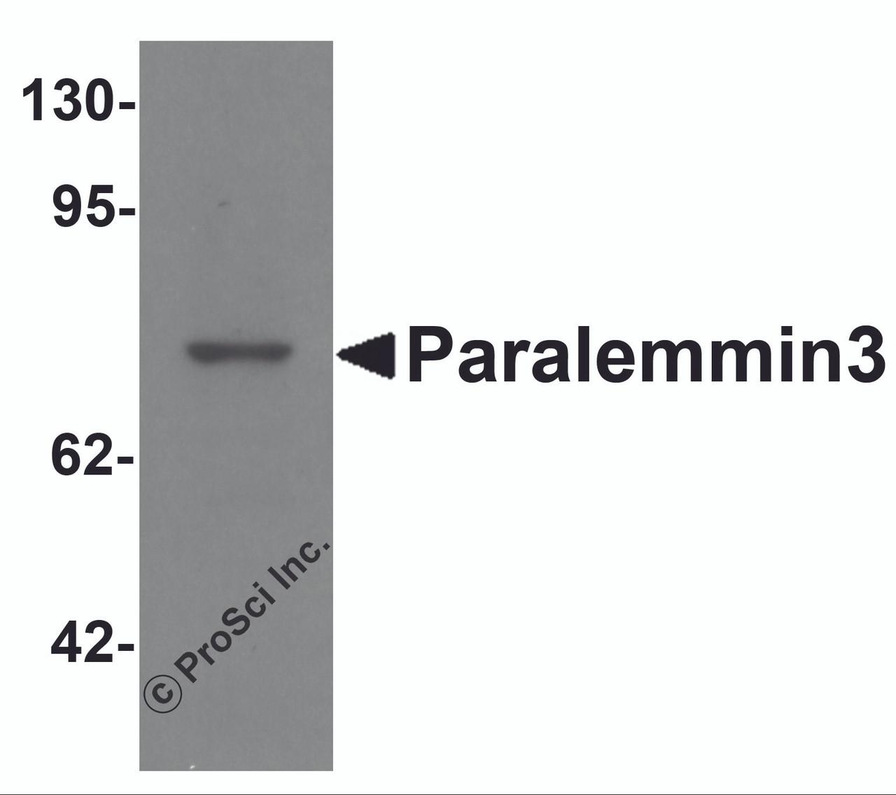 Western blot analysis of Paralemmin3 in MCF7 cell lysate with Paralemmin3 antibody at 1 &#956;g/mL.