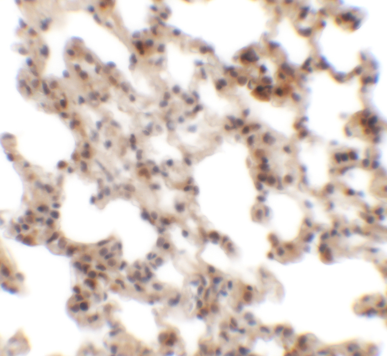 Immunohistochemistry of Coronin 7 in rat lung tissue with Coronin 7 antibody at 2.5 ug/mL.