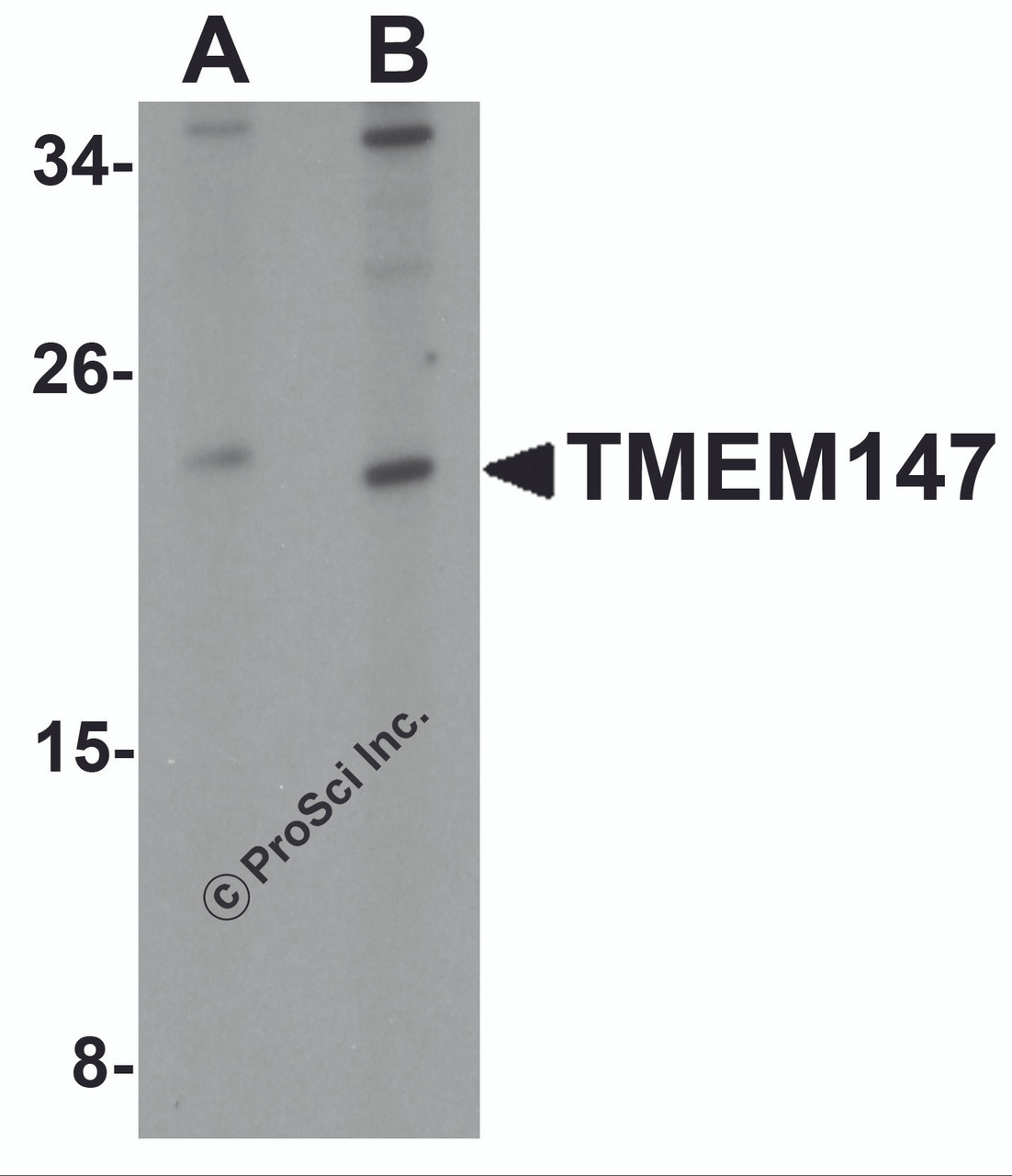 Western blot analysis of TMEM147 in Daudi cell lysate with TMEM147 antibody at (A) 1 and (B) 2 &#956;g/mL.