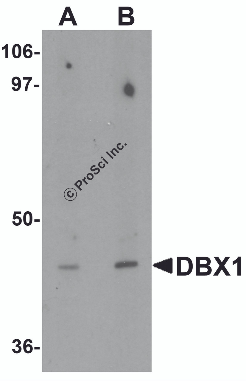 Western blot analysis of DBX1 in mouse kidney tissue lysate with DBX1 antibody at (A) 1 and (B) 2 &#956;g/mL.