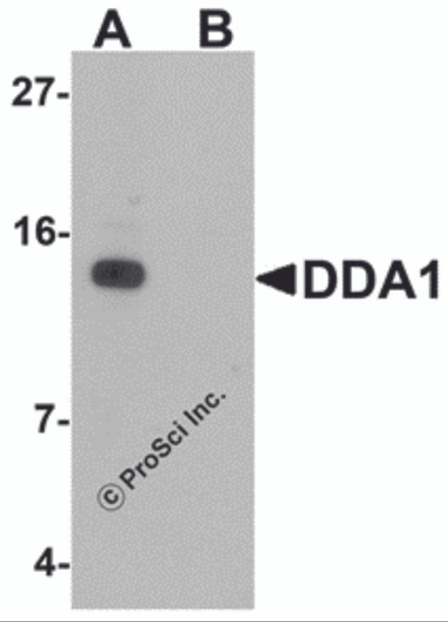 Western blot analysis of DDA1 in mouse heart tissue lysate with DDA1 antibody at 1 &#956;g/mL in (A) the absence and (B) the presence of blocking peptide