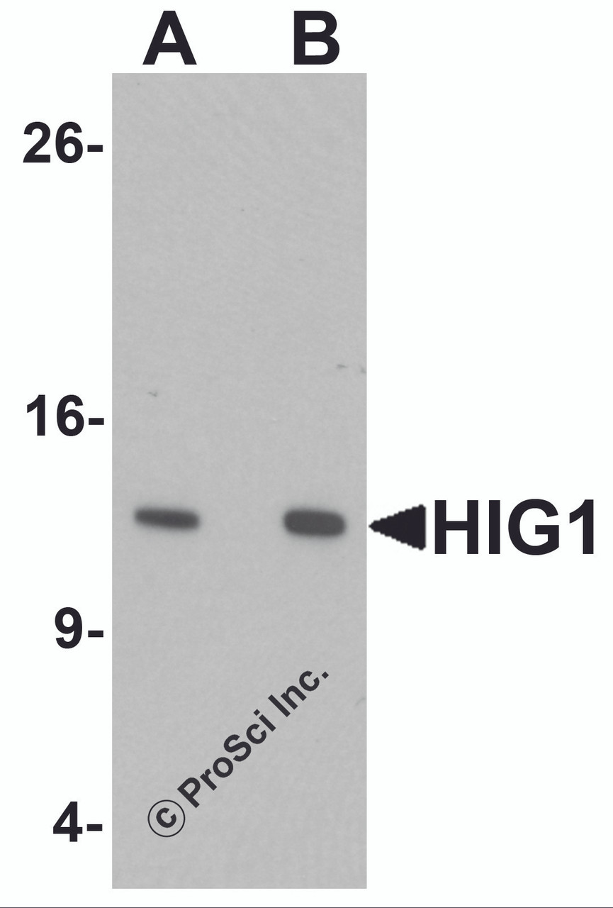 Western blot analysis of HIG1 in 293 cell lysate with HIG1 antibody at at (A) 0.5 and (B) 1 &#956;g/mL.