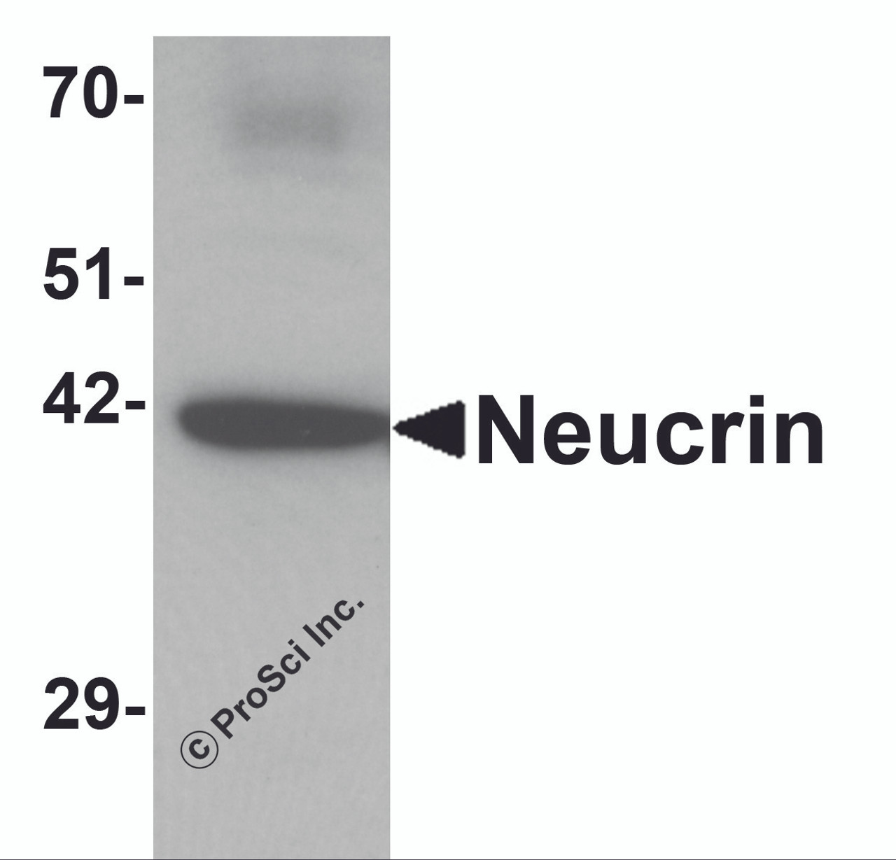 Western blot analysis of Neucrin in rat cerebellum tissue lysate with Neucrin antibody at 1 &#956;g/mL.