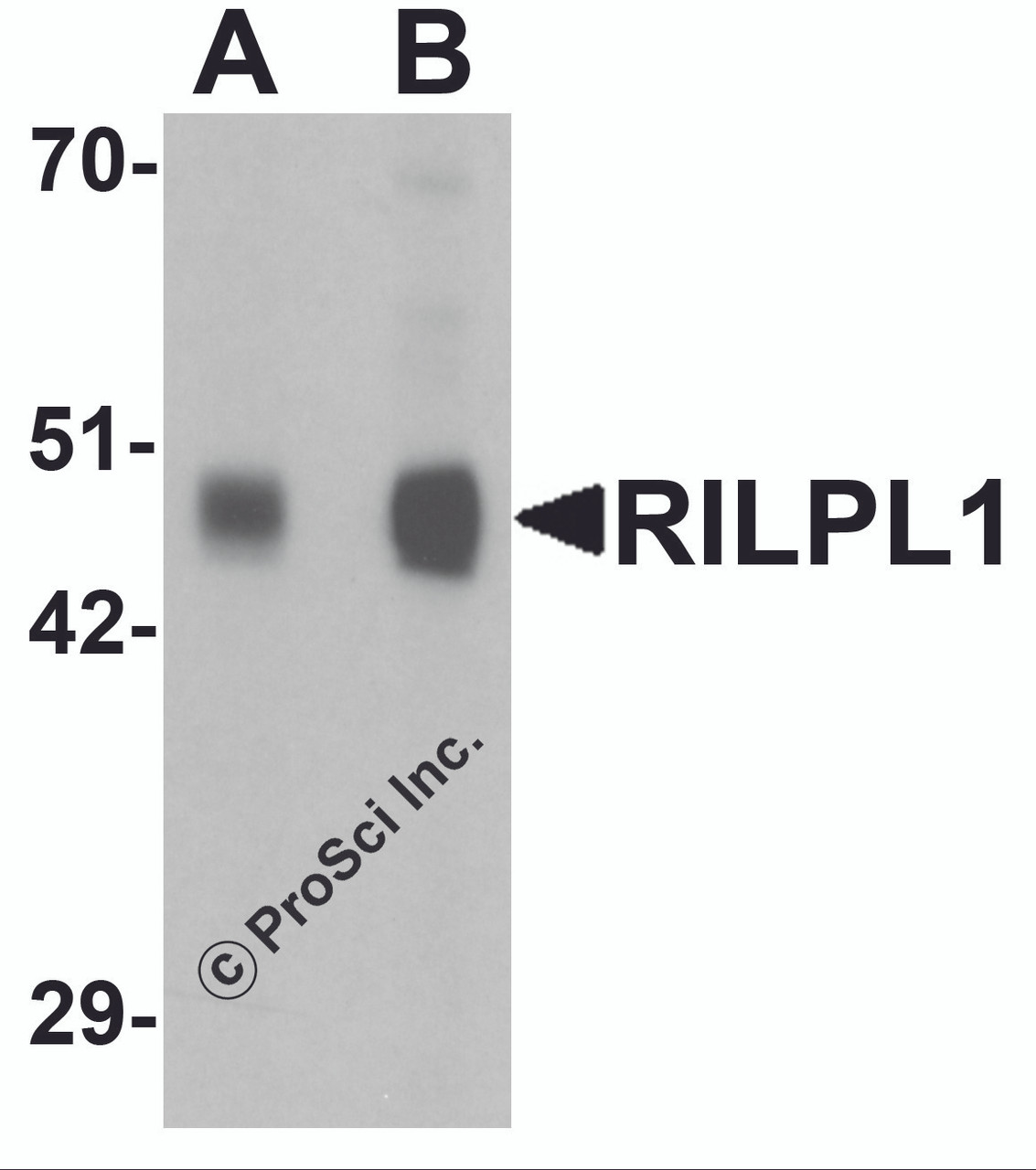 Western blot analysis of RILPL1 in rat cerebellum tissue lysate with RILPL1 antibody at (A) 0.5 and (B) 1 &#956;g/mL.