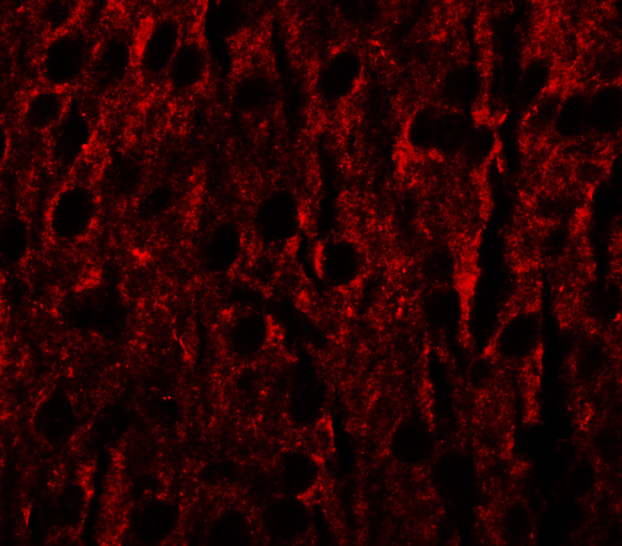 Immunofluorescence of RILPL1 in mouse brain cells with RILPL1 antibody at 20 ug/mL.