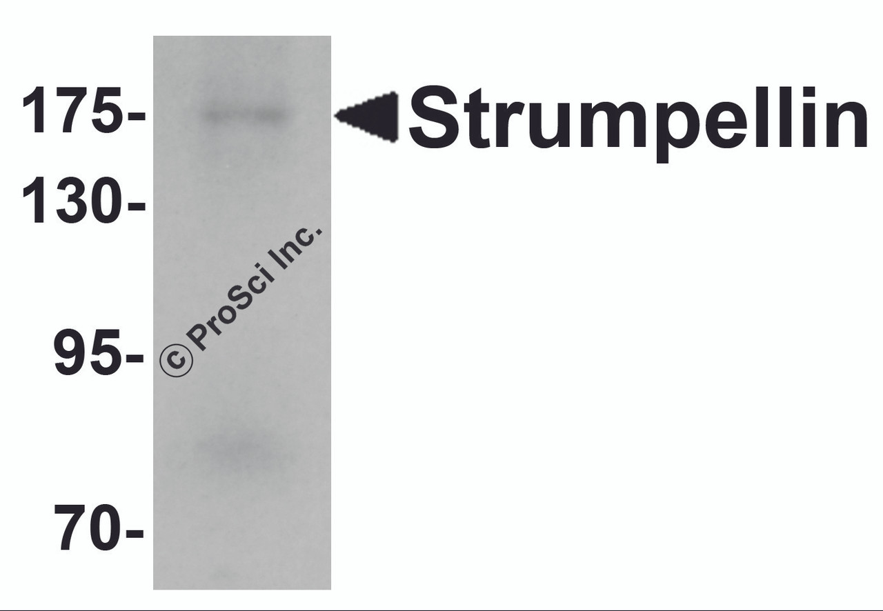 Western blot analysis of Strumpellin in human ovary tissue lysate with Strumpellin antibody at 1 &#956;g/mL.