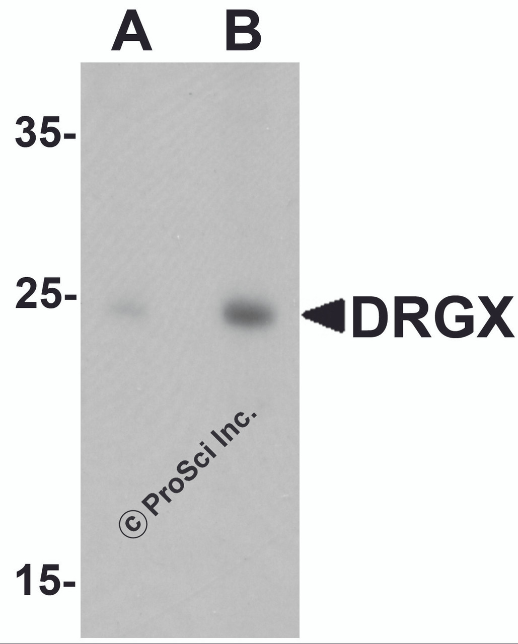 Western blot analysis of DRGX in rat liver tissue lysate with DRGX antibody at (A) 1 and (B) 2 &#956;g/mL.