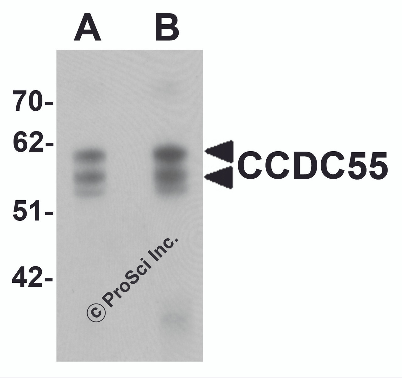 Western blot analysis of CCDC55 in human brain tissue lysate with CCDC55 antibody at (A) 0.5 and (B) 1 &#956;g/mL