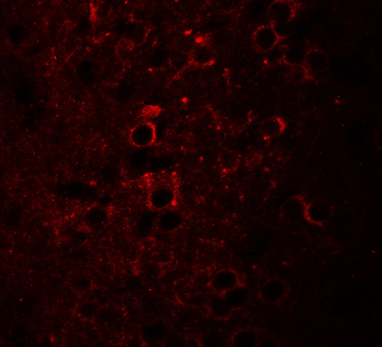 Immunofluorescence of CCDC55 in mouse brain cells with CCDC55 antibody at 20 ug/mL.