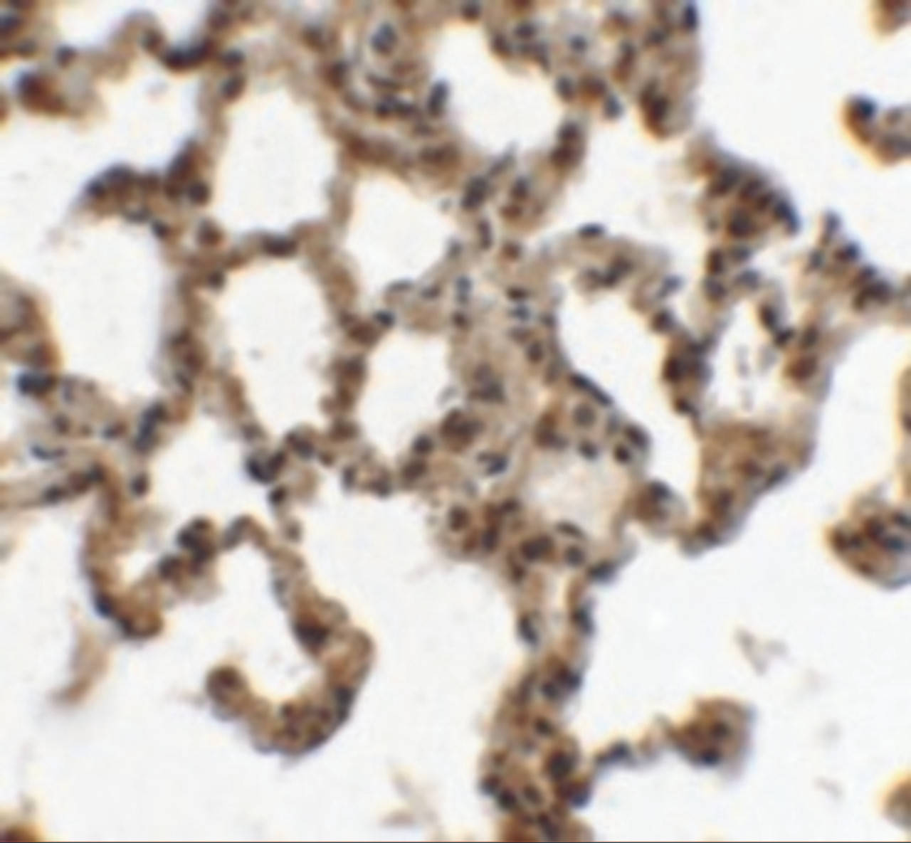 Immunohistochemistry of ECRG2 in rat lung tissue with ECRG2 antibody at 5 ug/mL.