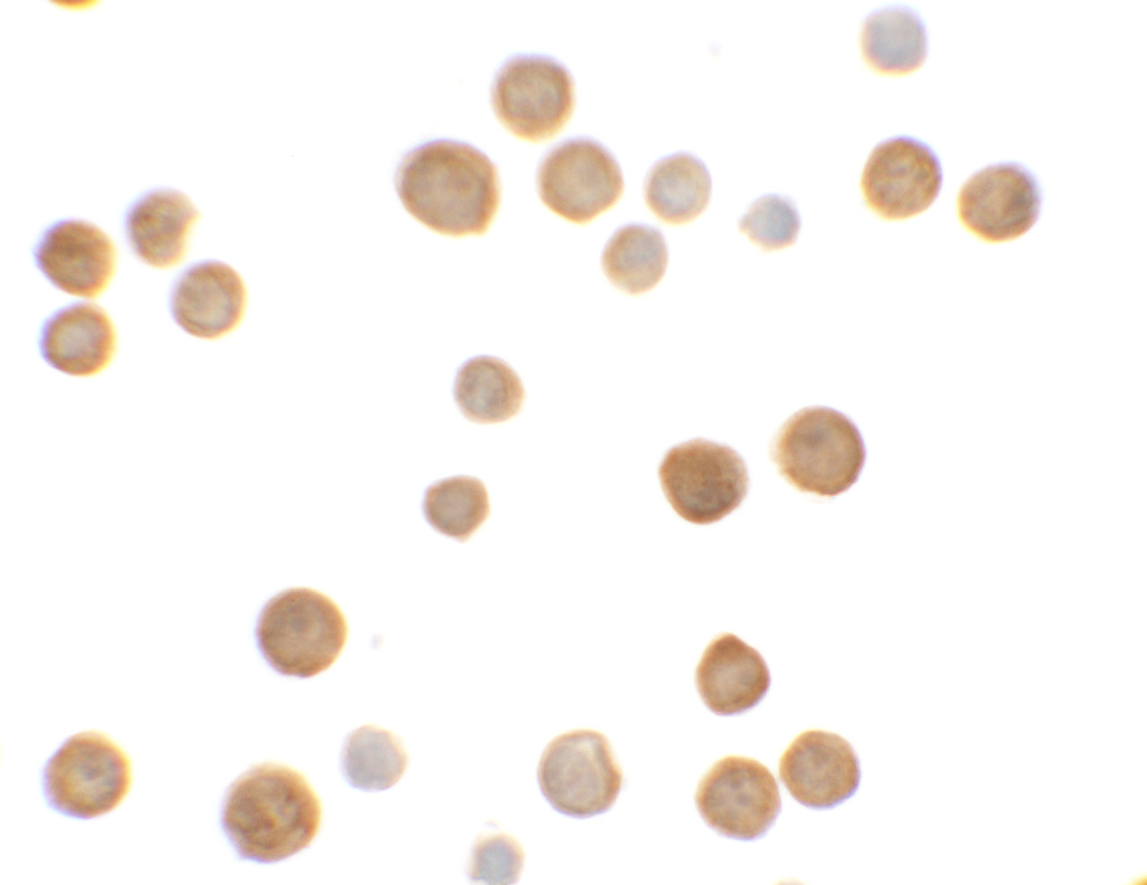 Immunocytochemistry of ECRG4 in HeLa cells with ECRG4 antibody at 5 ug/mL.