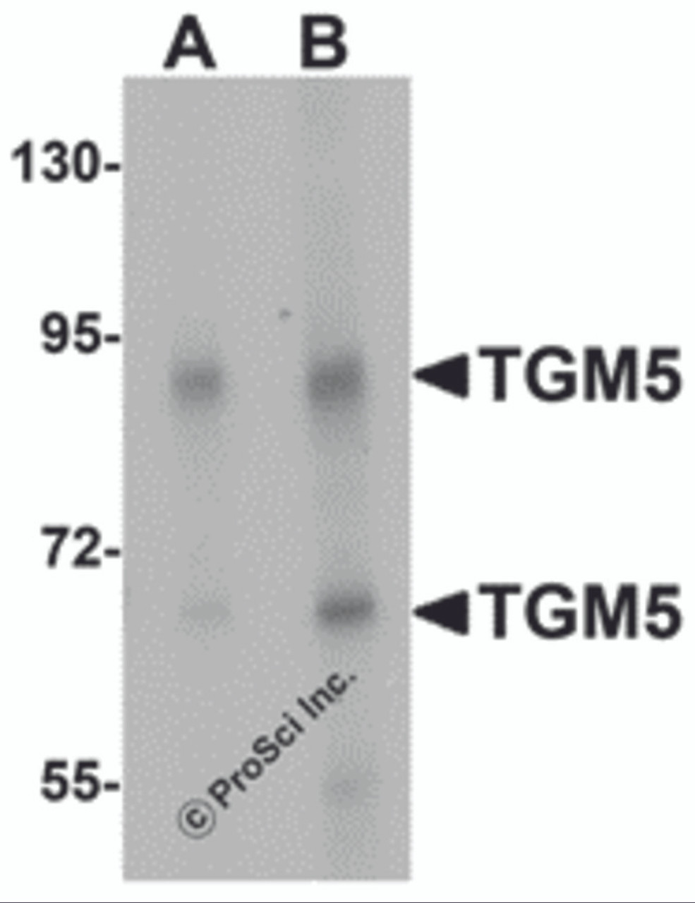 Western blot analysis of TGM5 in rat heart tissue lysate with TGM5 antibody at (A) 1 and (B) 2 &#956;g/mL.