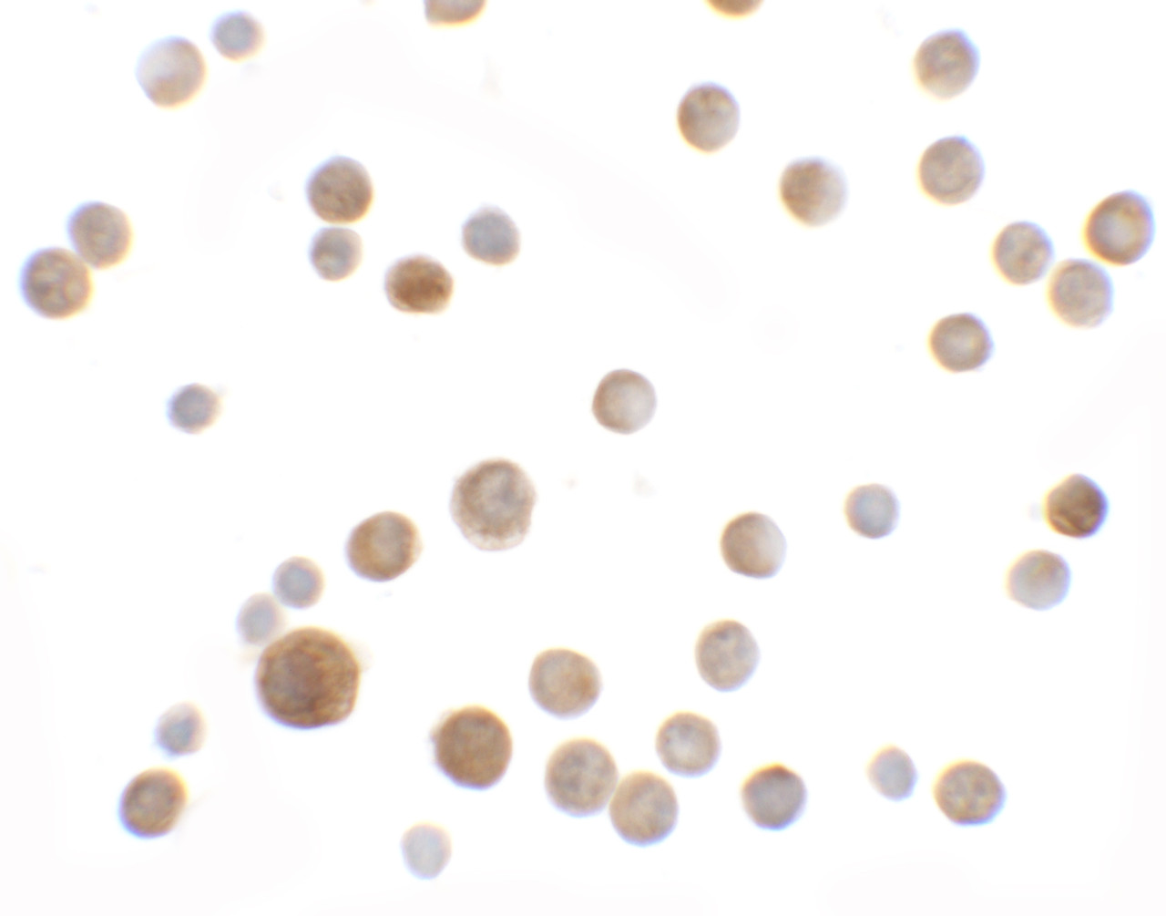 Immunocytochemistry of SLC35D2 in HeLa cells with SLC35D2 antibody at 5 ug/mL.