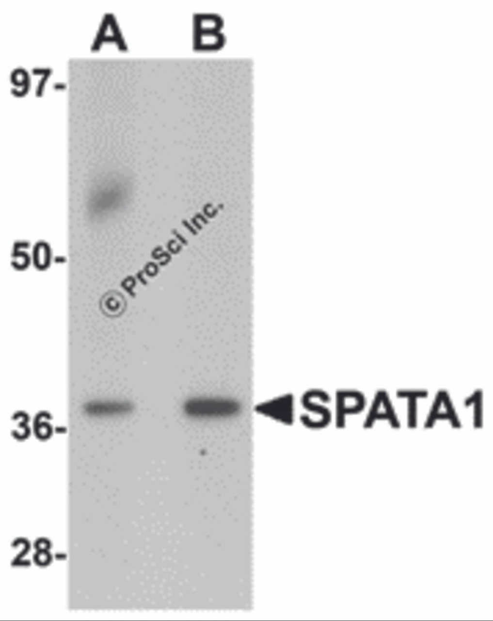 Western blot analysis of SPATA1 in A20 cell lysate with SPATA1 antibody at (A) 1 and (B) 2 &#956;g/mL.