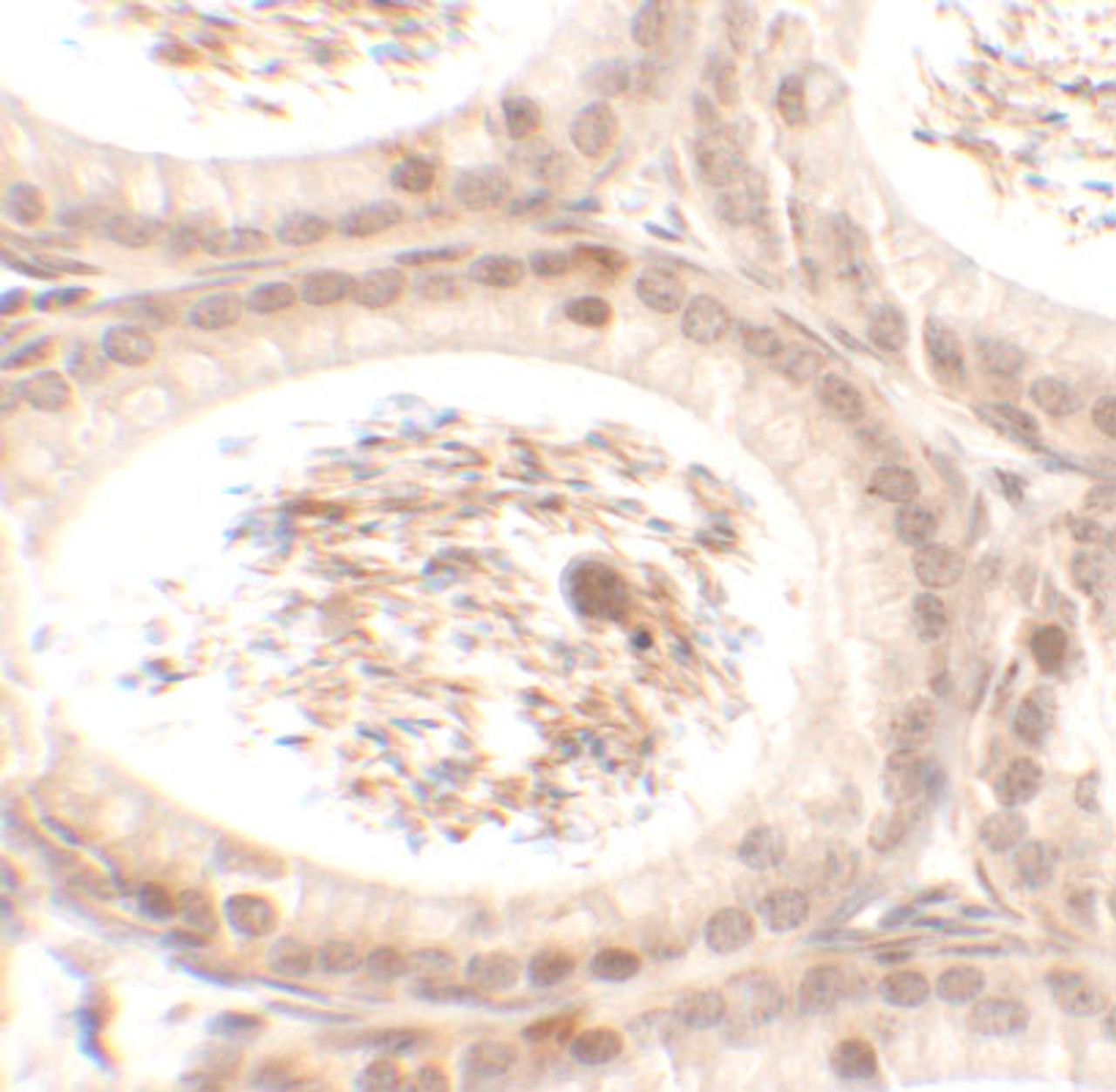 Immunohistochemistry of SPATA3 in mouse testis tissue with SPATA3 antibody at 2.5 ug/mL.
