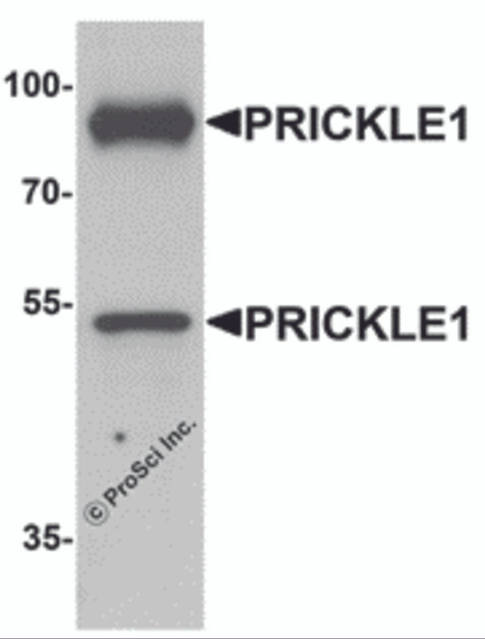 Western blot analysis of PRICKLE1 in human bladder tissue lysate with PRICKLE1 antibody at 1 &#956;g/mL.