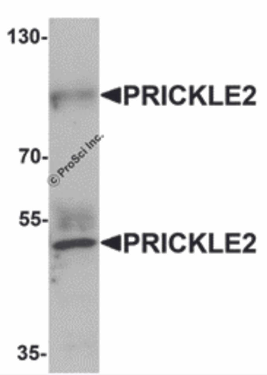 Western blot analysis of PRICKLE2 in A-20 lysate with PRICKLE2 antibody at 1 &#956;g/mL.