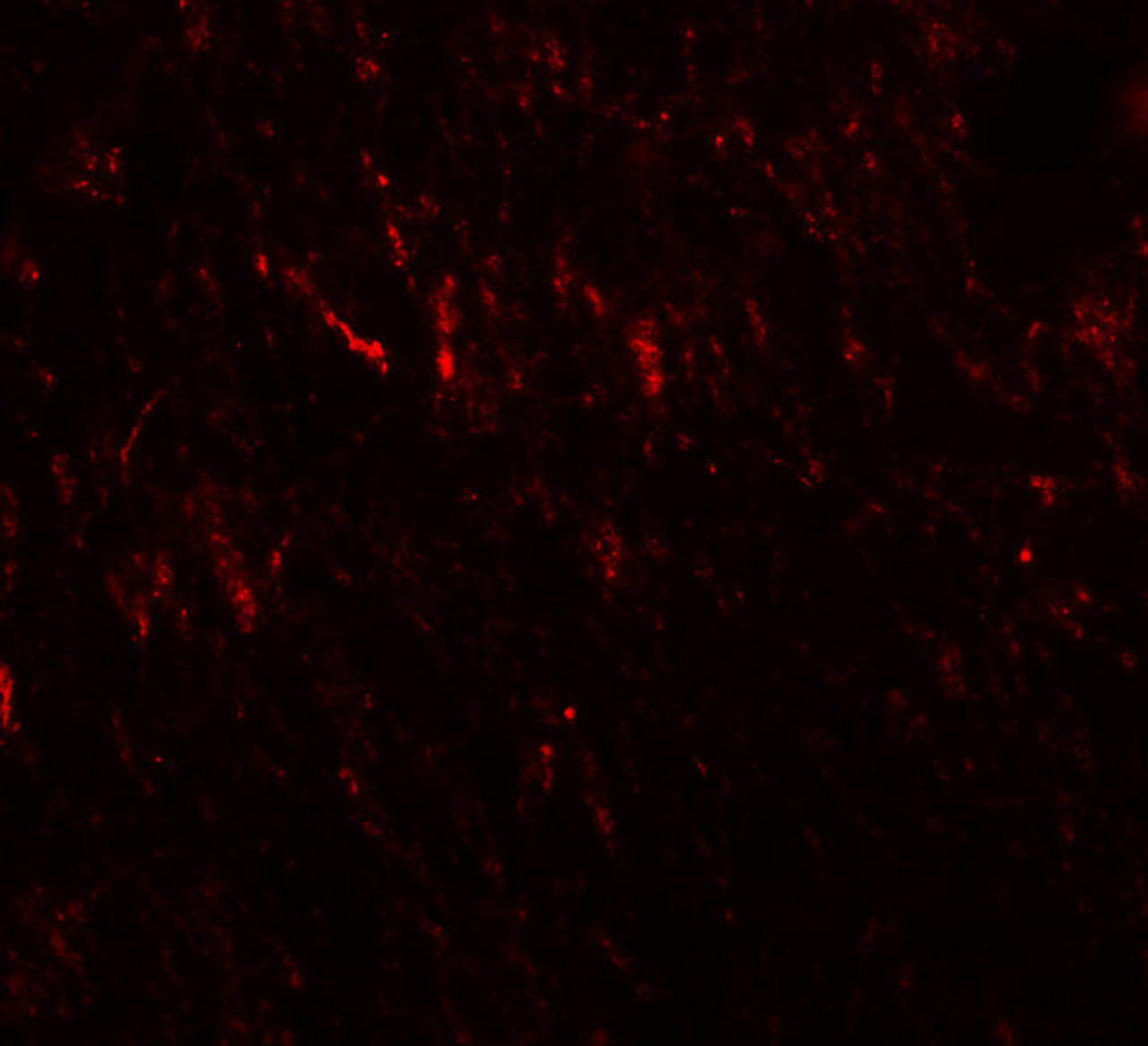 Immunofluorescence of PRICKLE2 in rat brain cells with PRICKLE2 antibody at 20 ug/mL.