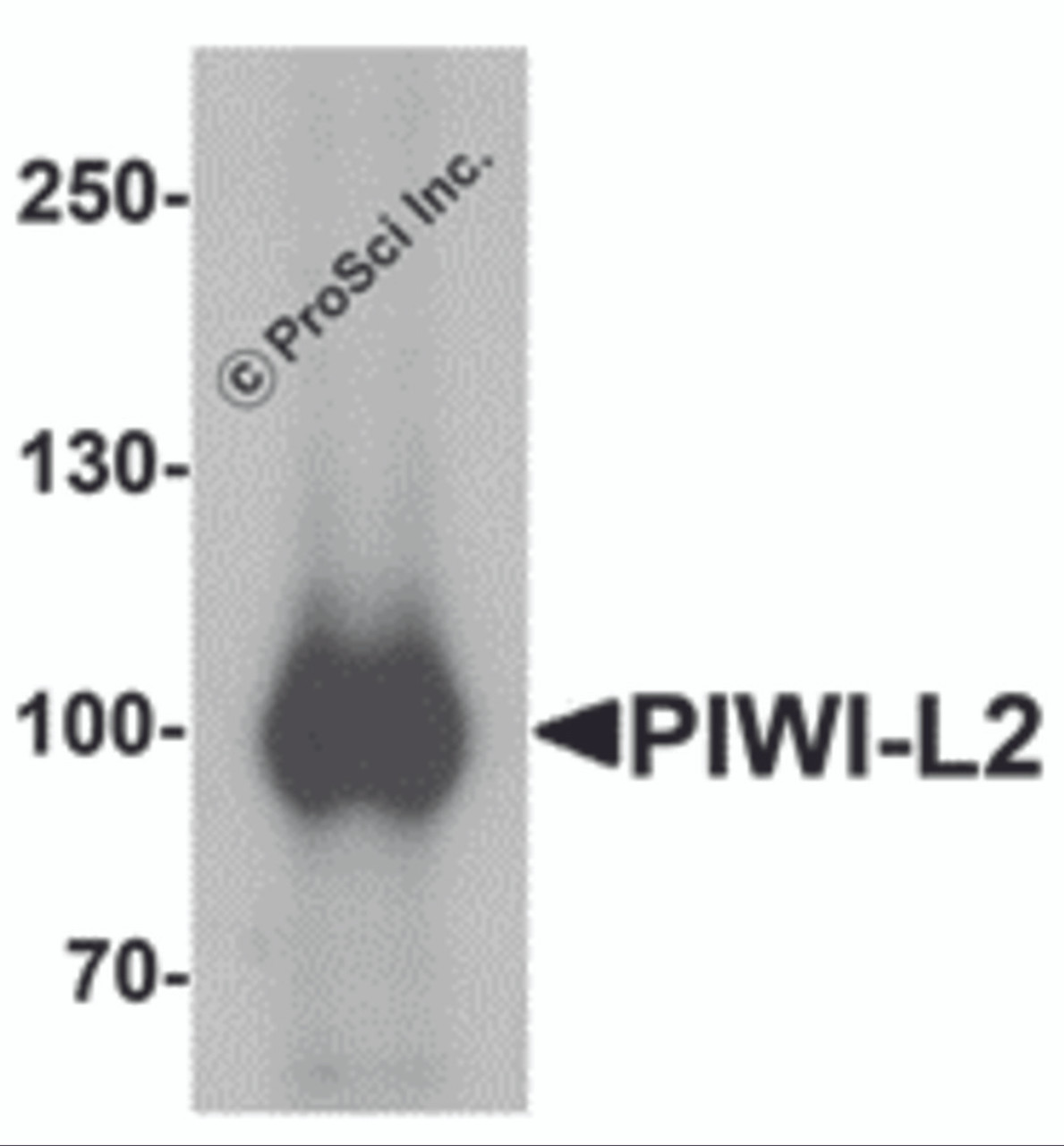 Western blot analysis of PIWI-L2 in HepG2 cell lysate with PIWI-L1 antibody at 1 &#956;g/mL.